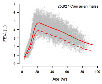Distribution of residual of FEV1 versus age
