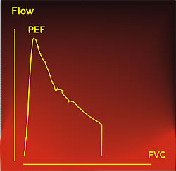 Flow-volume curve with premature end, incomplete expiration