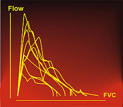 Poorly reproducible maximum expiratory flow-volume curves