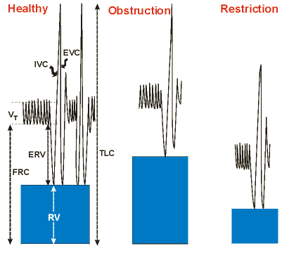 Subdivision of lung volumes in various conditions