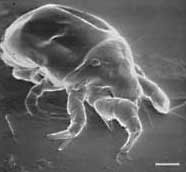 House dust mite, the products of which may induce bronchial hyperresponsiveness