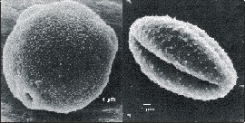 Electron microscopic view of two pollen