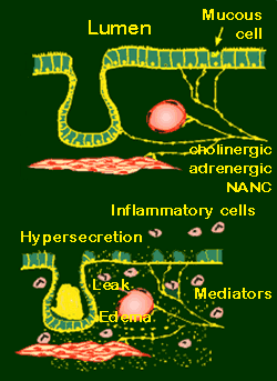 Schematic representation of healthy and sick airway wall and neural control mechanisms